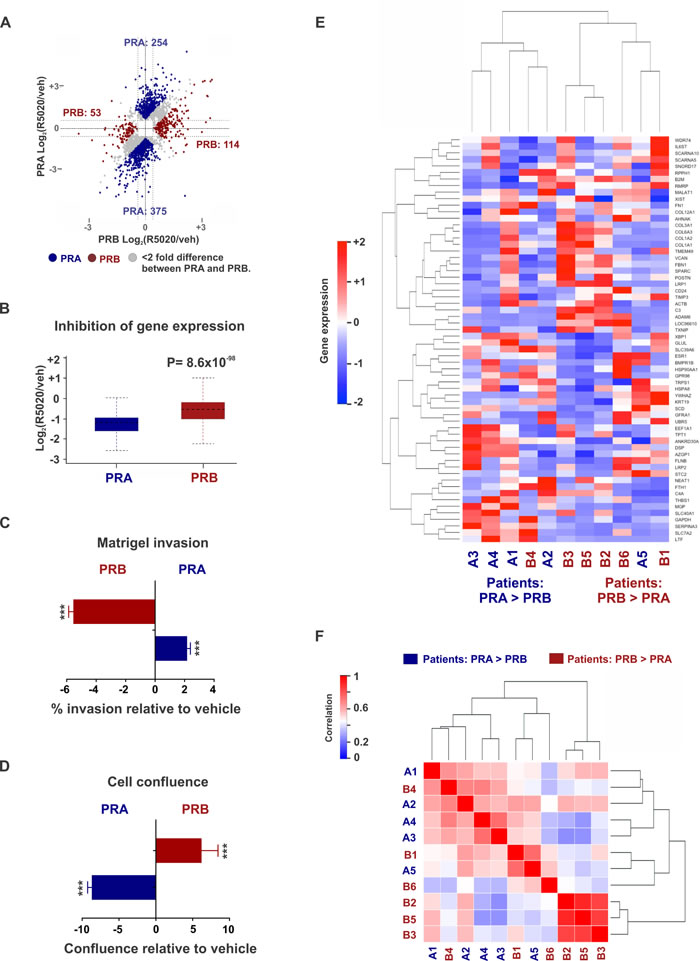 Differential gene expression in patient tumors expressing disproportionate levels of PRA and PRB.