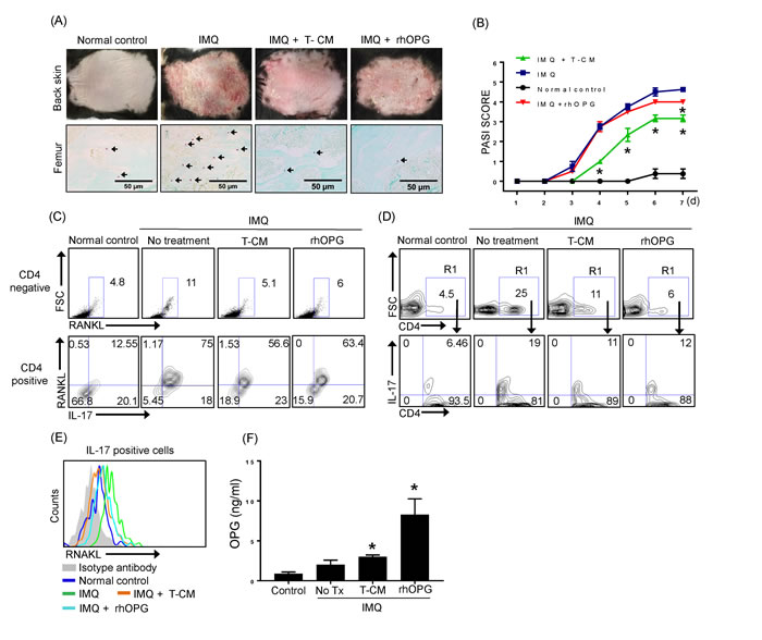 IMQ-induced skin inflammation and the frequency of TRAP+ cells in bone marrow were reduced following T-CM injection in a psoriasis mouse model.
