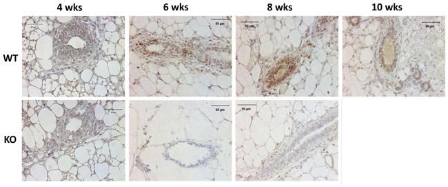 Analysis of Kdm3a protein in the mouse mammary gland by IHC.