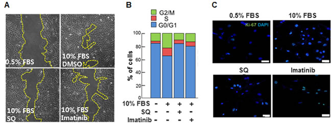 Effect of miR-9 inducing small molecule on VSMC migration and cell cycle progression.