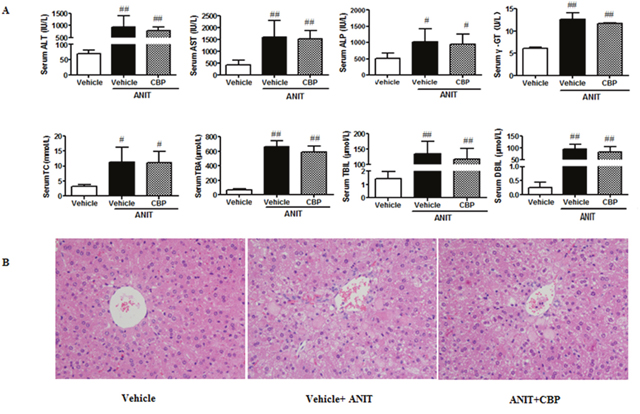 Effects of CBP on ANIT-induced intrahepatic cholestasis in FXRKO mice.