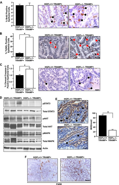 Prostate tumor characterization from HGFL+/+ TRAMP+ and HGFL-/- TRAMP+ mice.