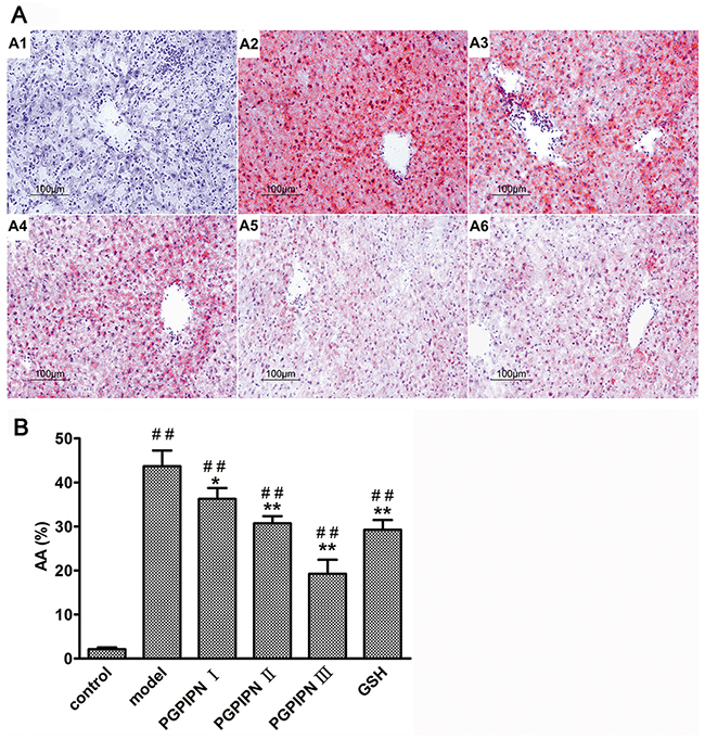 PGPIPN attenuated hepatocyte steatosis of model animals induced with alcohol-intake in vivo.