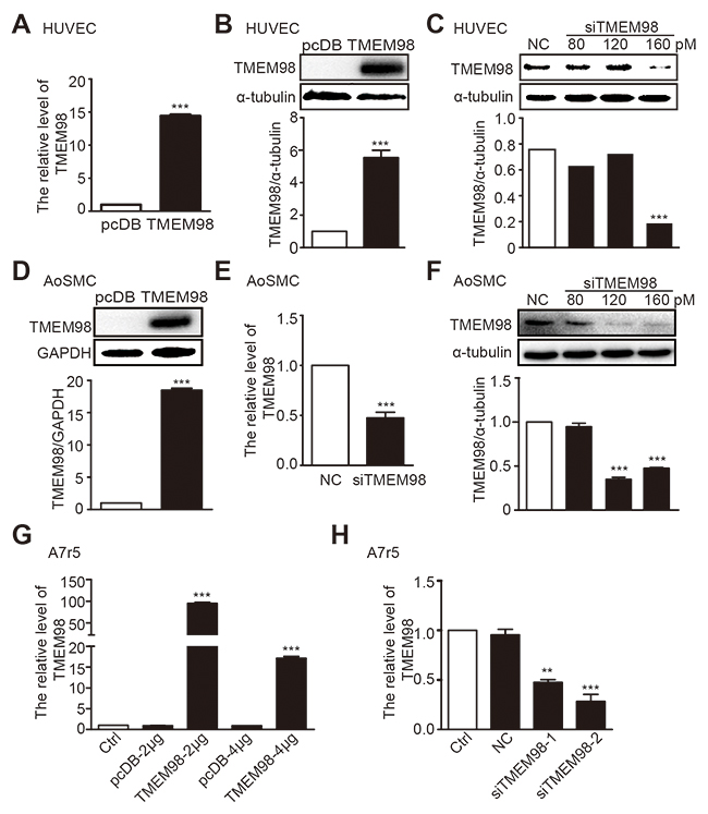 The expression of TMEM98 by down-, up-regulation TMEM98 gene in HUVEC, AoSMC and A7r5.