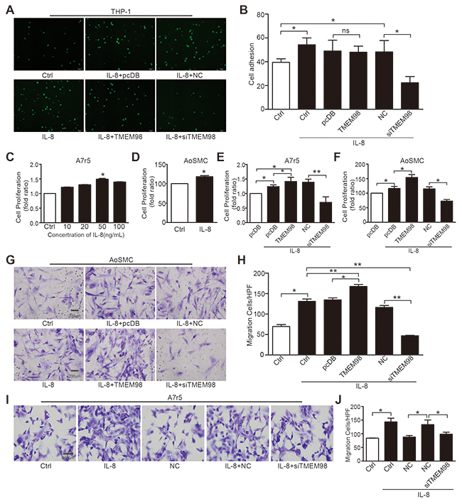 Effects of down-, up-regulation of TMEM98 gene on IL-8-induced vascular wall cell function.
