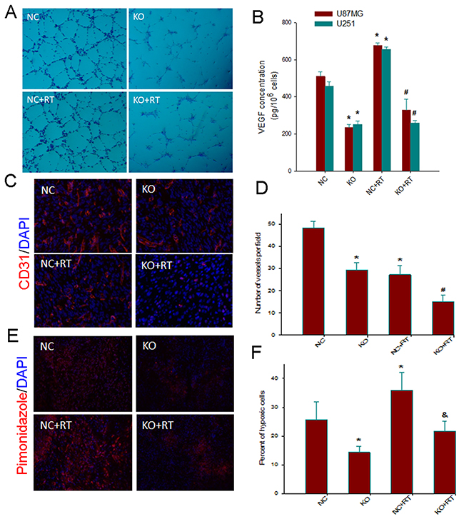 Notch1 downregulation impairs angiogenesis and attenuates VEGF and hypoxic response to irradiation.