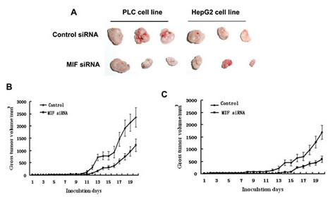 The effects of MIF knockdown on PLC and HepG2 cell growth in nude mice.
