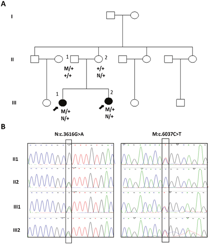 Mutations of the FBN3 gene in a Chinese family with BBS syndrome.
