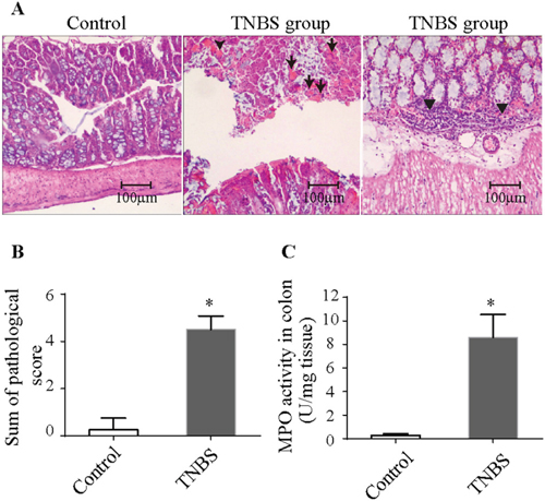 Histopathologic changes and MPO activity in TNBS-induced colitis.