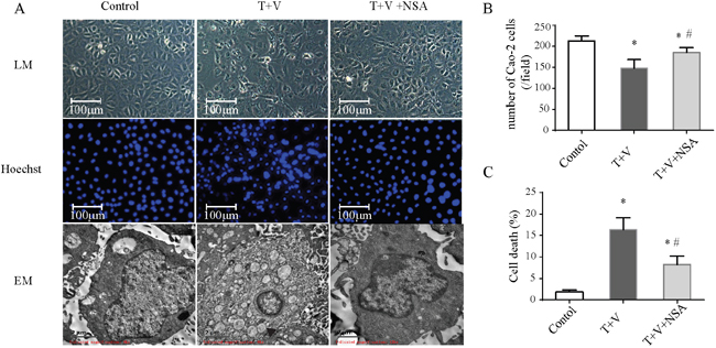 Morphologic changes in Caco-2 cells treated with TNF-&#x03B1; (T) and Z-VAD-fmk (V) with or without necrosulfonamide (NSA).