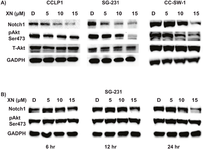 XN treatment alters Notch1 and PI3-K/AKT pathway.