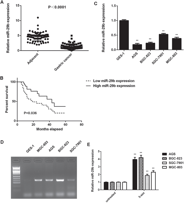 High methylation contributes to the downregulated of miR-29b in gastric cancer.