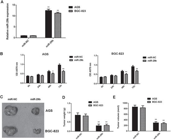 Overexpression of miR-29b inhibits gastric cancer cell growth in vitro and in vivo.