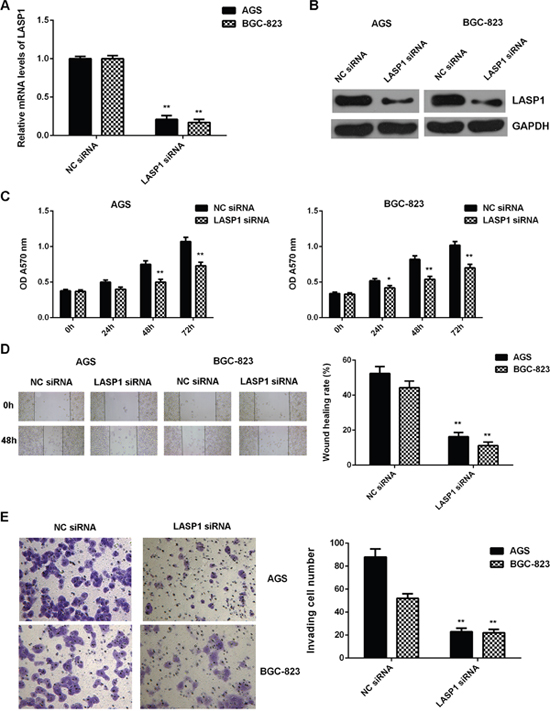 Knockdown of LASP1 inhibits the malignant phenotypes of gastric cancer cells.