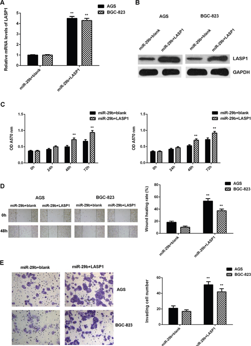 Overexpression of LASP1 impaired the suppressive effects of miR-29b on the proliferation, migration, and invasion of gastric cancer cells.