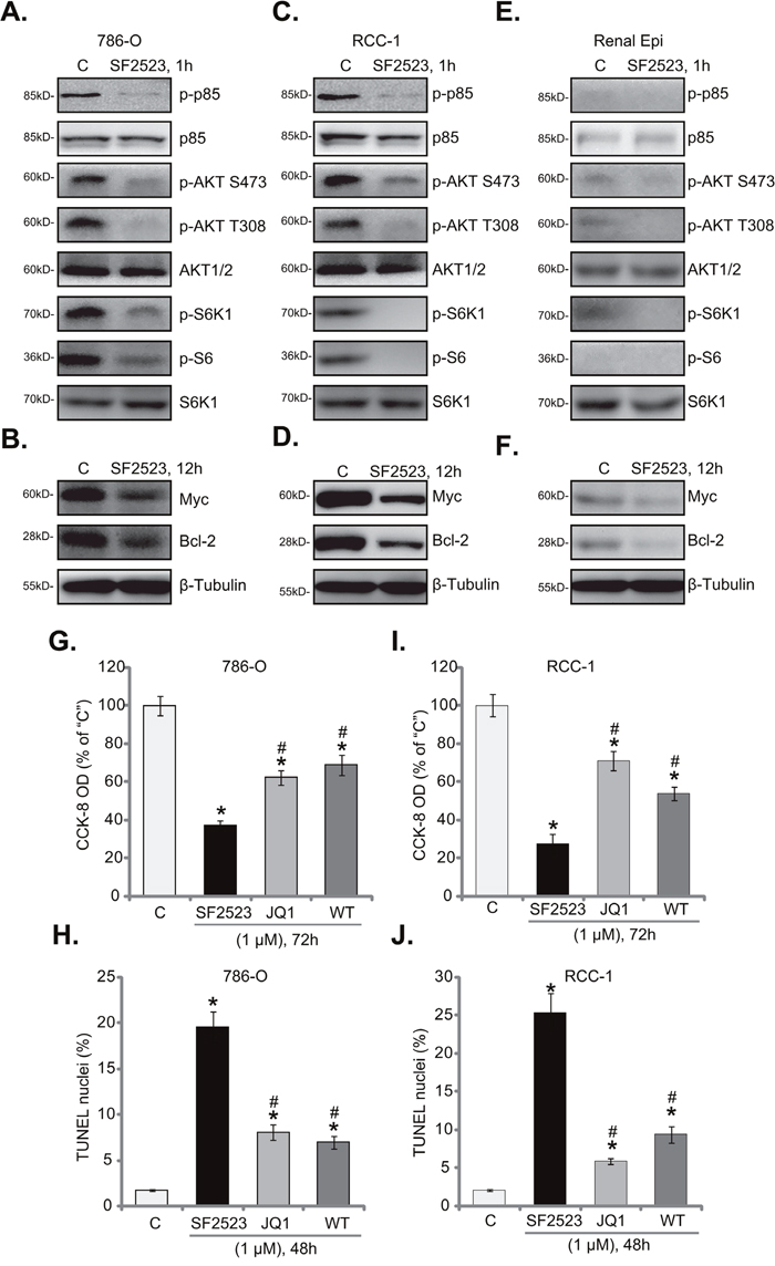 SF2523 blocks PI3K-AKT-mTOR and BRD4 signalings in RCC cells.