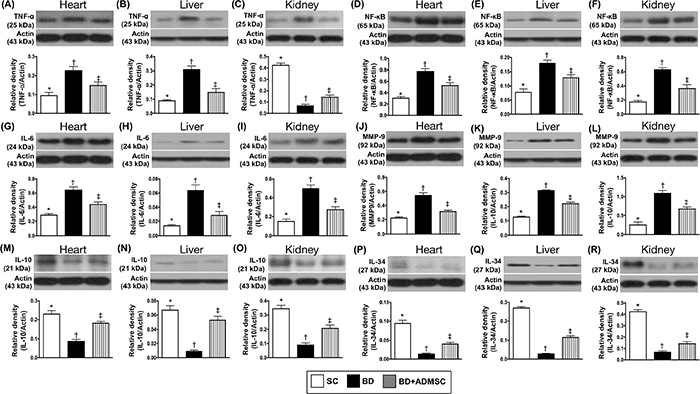 Protein expressions of inflammatory and anti-inflammatory biomarkers of heart, liver and kidney by 6 h after BD procedure.