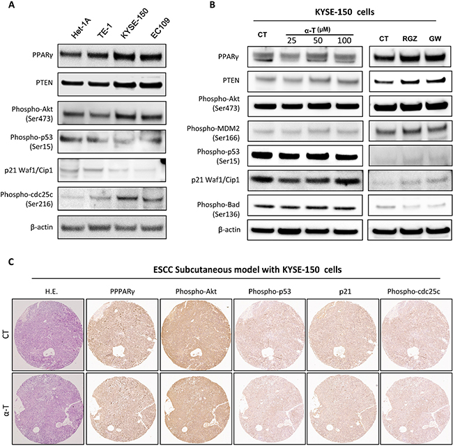 &#x03B1;-Tocopherol was not effective in activating PPAR&#x03B3; and deactivating Akt in esophageal cancerous cells.