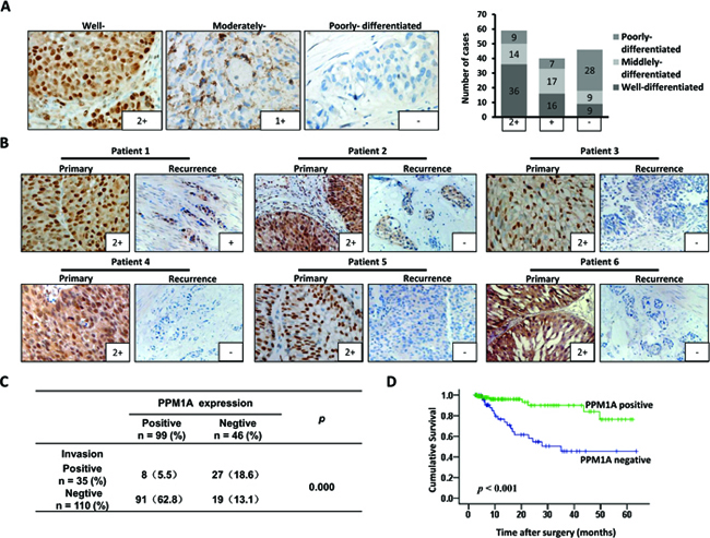 PPM1A expression correlated with prognosis and muscle invasion in patients with BCa