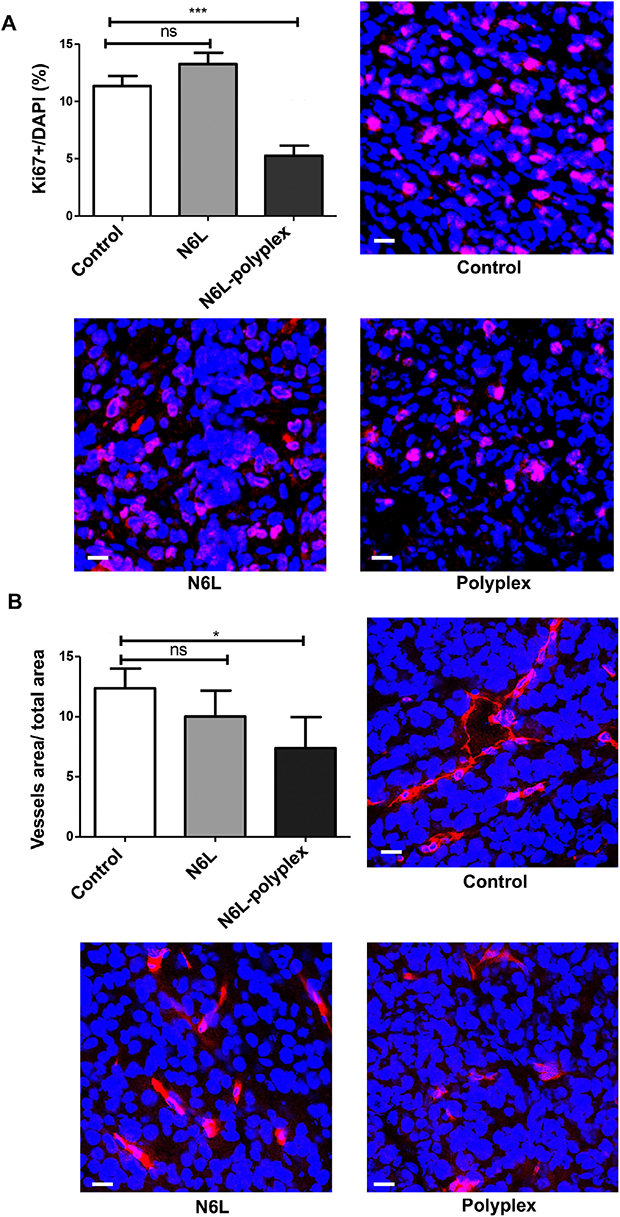 Effect of N6L-polyplexes on tumour proliferation and vascularisation.