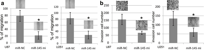 miR-145 expression and U87 and U251 cell migration and invasion.