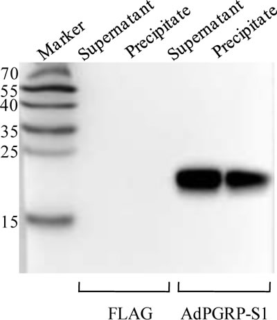 Figure 4:The extracellular and intracellular expression of AdPGRP-S1 in HEK-293T cell medium and lysates by western-blotting.