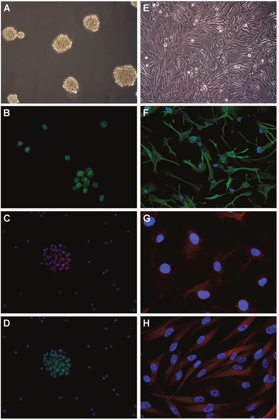 Development of cell lines by in vitro culture of newly diagnosed GB and immunofuorescence.