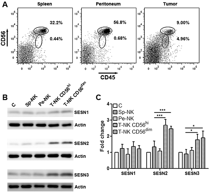 Intratumoral NK-92 cells up-regulate SESN2 and SESN3 expression.