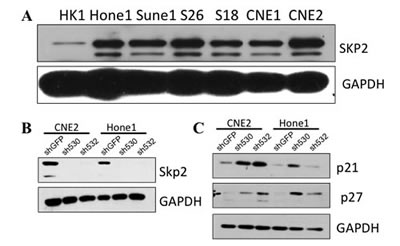 Skp2 expresses high in several NPC cell lines .