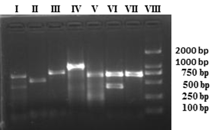 Detection of plasmid replicon types in ESBL-producing E. coli using PCR assay.
