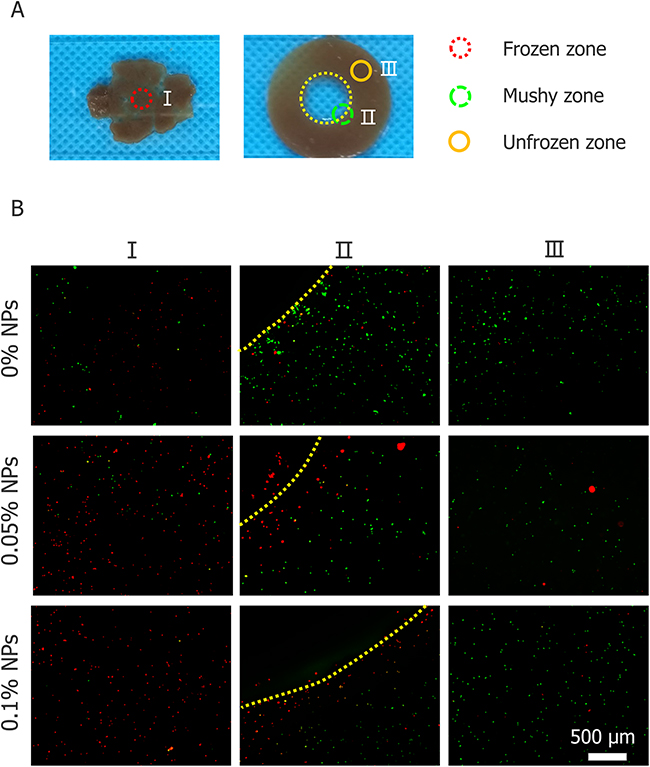 Cell viability of three regions of tumor model.