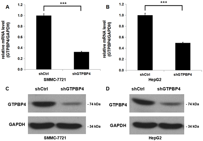 Efficient shRNA-mediated knockdown of GTPBP4 in HCC cell lines.