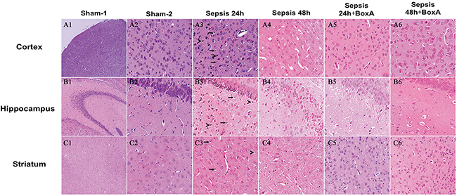 HE staining of brain tissues for assessing morphological changes (magnification: A1, B1, C1: &times;100, A2-6, B2-6, C2-6: &times;400).