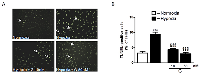 Effect of G on hypoxia-induced cell apoptosis.