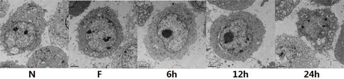 FNSCs were observed under Transmission Electron Microscope (TEM) treated with 9.56mM EI for different durations (6 h, 12 h and 24 h).