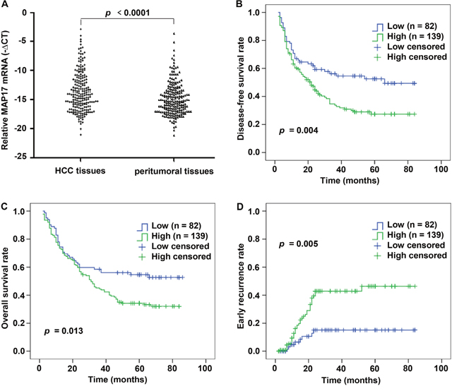 MAP17 expression is increased in HCC samples by qRT-PCR and correlated with unfavorable prognosis in HCC cohort.