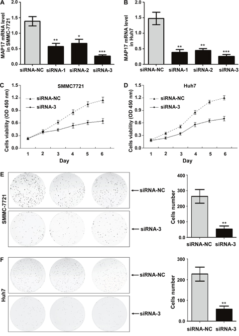 The effect of MAP17 on the growth and proliferation of HCC cells in vitro.