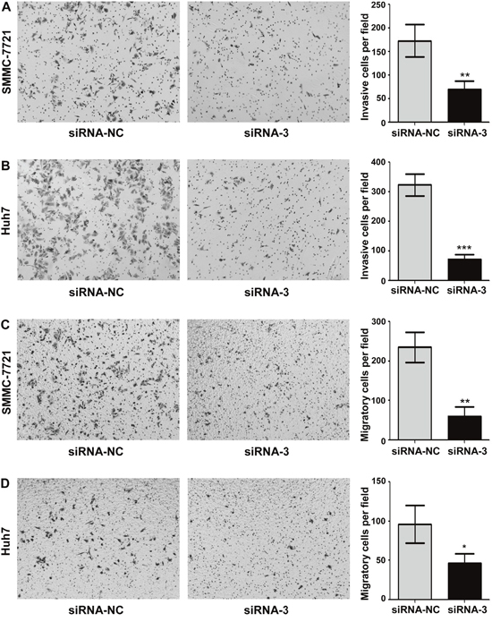 Knockdown of MAP17 inhibited the invasion and migration of HCC cells in vitro.