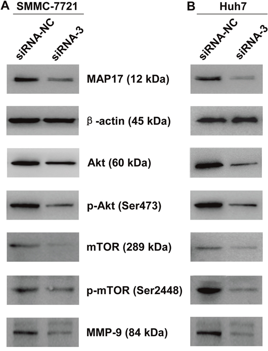 Downregulation of MAP17 inhibited Akt/mTOR signaling pathway in HCC cells.