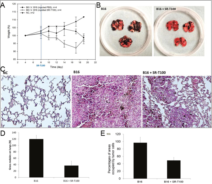 Effect of SR-T100 on metastasis in vivo.