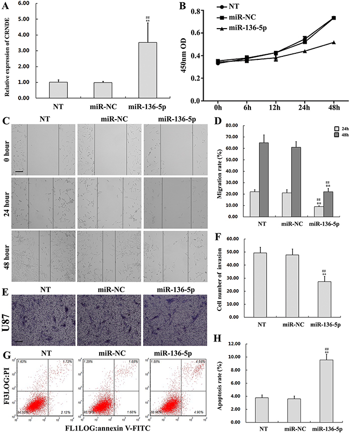 Overexpression of miR-136-5p inhibits proliferation, migration, and invasion, and promotes apoptosis in glioma cells.
