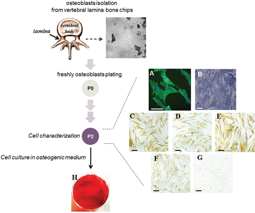 Characterization of the cells obtained from vertebral lamina bone chips.