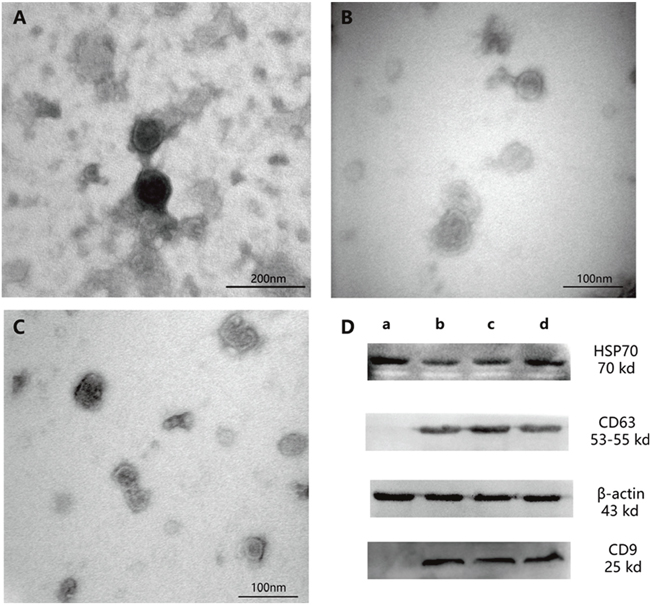 Exosomes as observed by electron microscopy and western blotting analysis.