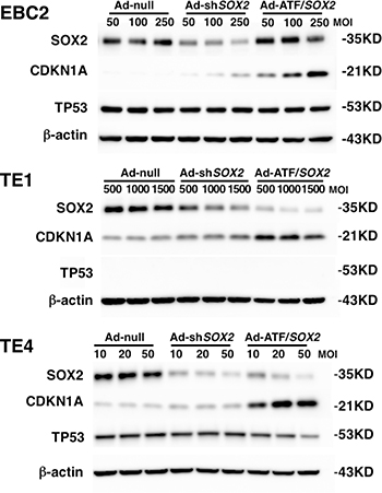 Ad-ATF/SOX2 up-regulated CDKN1A in lung and esophageal SCC cells more robustly than Ad-shSOX2.