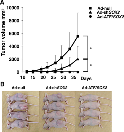 Effect of EBC2 xenograft tumor volumes as a function of time and treatment with adenoviral vectors.