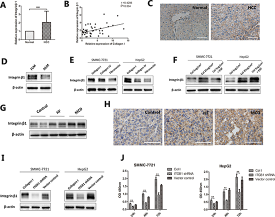 The expression of integrin &#x03B2;1 in NAFLD-related HCC.