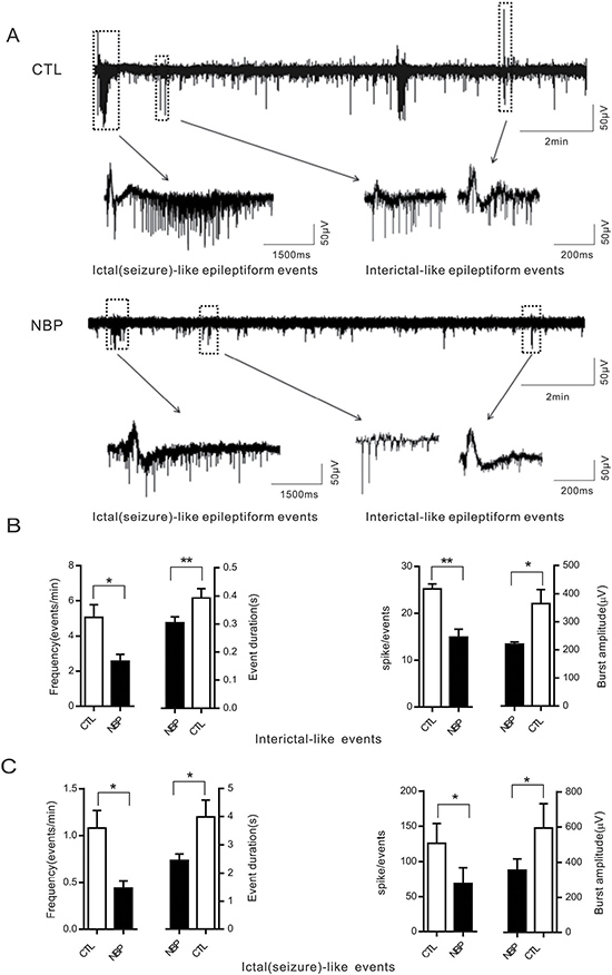 Epileptiform-like activity triggered in acute hippocampal slices significantly decreased by NBP in extracellular recordings.