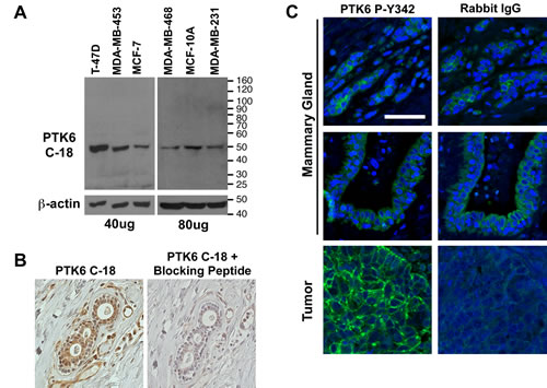 Controls were performed to confirm the specificity of PTK6 antibody for detection of PTK6 in nontransformed cells and tissues.