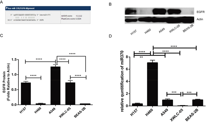 EGFR and miR370 expression in lung cancer cells.