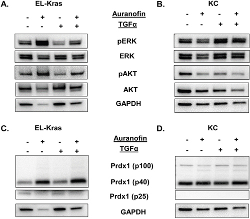 Regulation of the Txn system and its effect on ERK and AKT phosphorylation in primary culture of mutant Kras pancreatic cells.